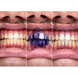 Hismile V34 dantų spalvą koreguojantis serumas 30 ml