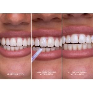 Hismile Glostik Tooth Gloss dantų blizgis 4 ml
