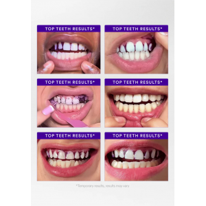 Hismile V34 Whitening Strips balinimo juostelės 14 vnt